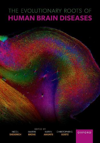 The Evolutionary Roots of Human Brain Diseases.