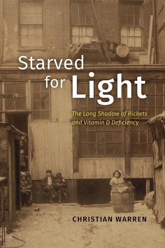 Starved for Light: The Long Shadow of Rickets and Vitamin D Deficiency.