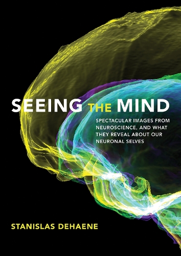 Seeing the Mind: Spectacular Images from Neuroscience, and What They Reveal about Our Neuronal Selves.