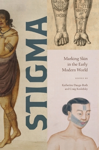Stigma