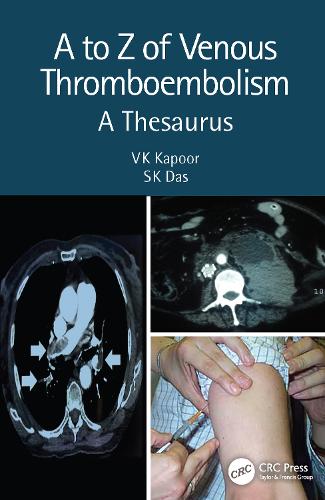 A to Z of Venous Thromboembolism: A Thesaurus. 2nd edition