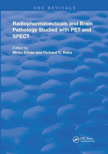 Radiopharmaceuticals and Brain Pathophysiology Studied with Pet and Spect.