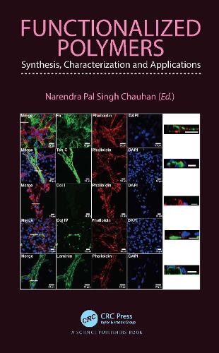 Functionalized Polymers: Synthesis, Characterization and Applications.