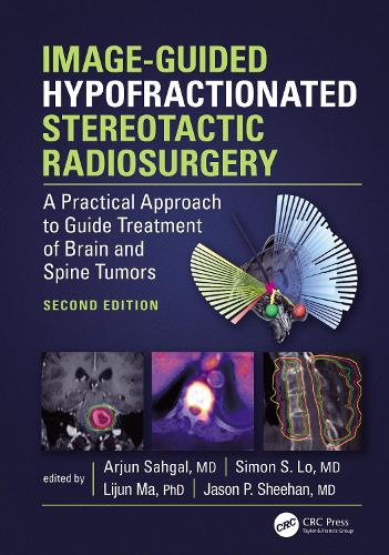 Image-Guided Hypofractionated Stereotactic Radiosurgery: A Practical Approach to Guide Treatment of Brain and Spine Tumors. 2nd edition
