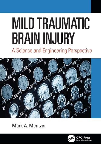 Mild Traumatic Brain Injury: A Science and Engineering Perspective.