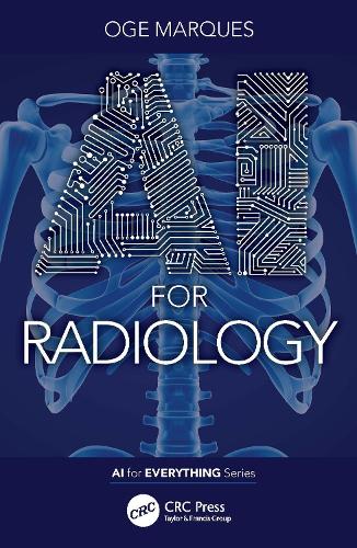 AI for Radiology.