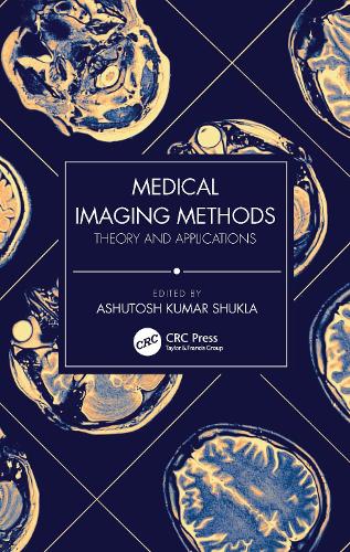 Medical Imaging Methods: Theory and Applications.