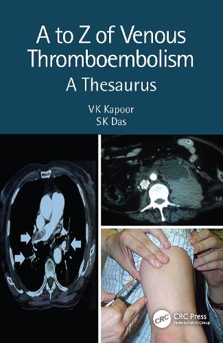A to Z of Venous Thromboembolism: A Thesaurus. 2nd edition
