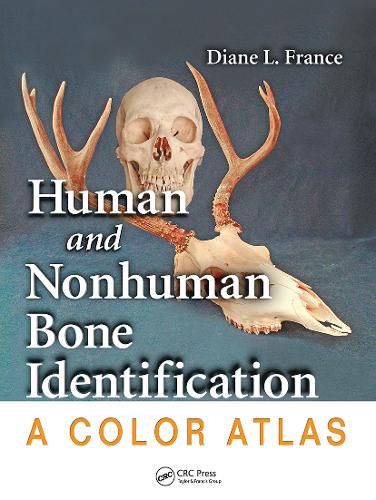 Human and Nonhuman Bone Identification: A Color Atlas.