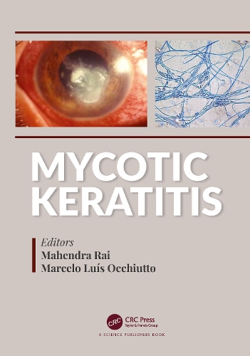 Mycotic Keratitis.