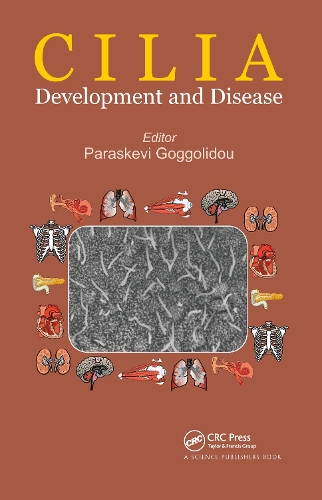 Cilia: Development and Disease.