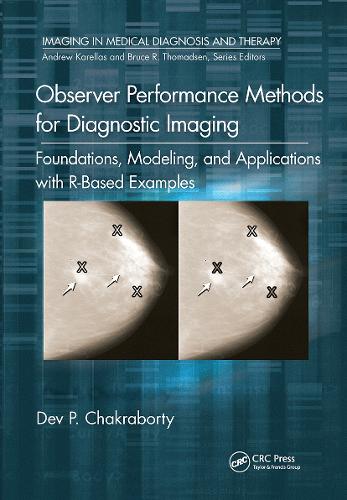 Observer Performance Methods for Diagnostic Imaging: Foundations, Modeling, and Applications with R-Based Examples.