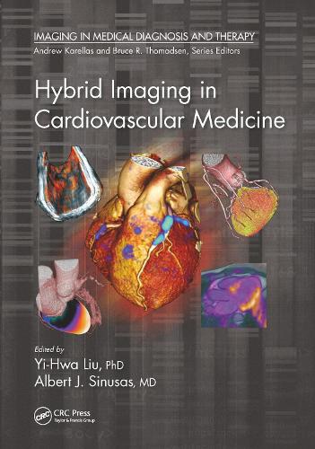 Hybrid Imaging in Cardiovascular Medicine.