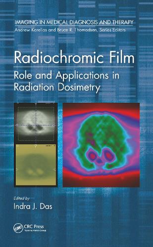 Radiochromic Film: Role and Applications in Radiation Dosimetry.