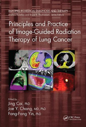 Principles and Practice of Image-Guided Radiation Therapy of Lung Cancer.