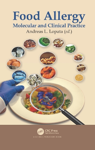 Food Allergy: Molecular and Clinical Practice.