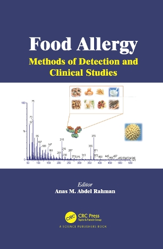 Food Allergy: Methods of Detection and Clinical Studies.