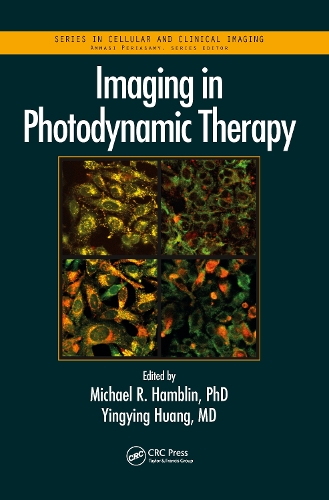 Imaging in Photodynamic Therapy.