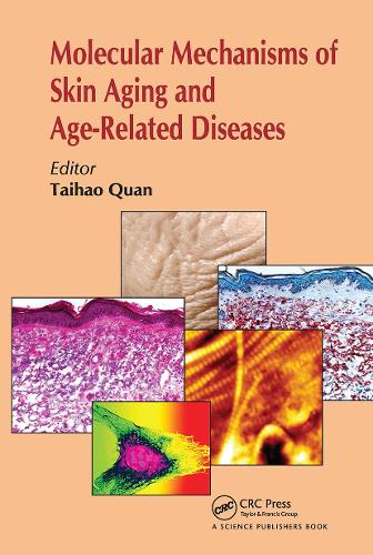 Molecular Mechanisms of Skin Aging and Age-Related Diseases.