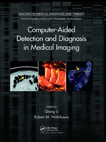Computer-Aided Detection and Diagnosis in Medical Imaging.