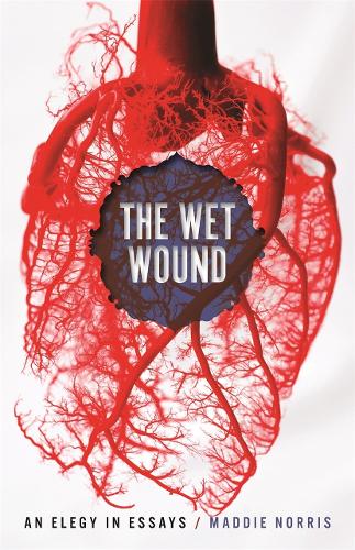 The Wet Wound: An Elegy in Essays.