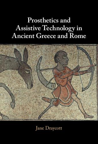 Prosthetics and Assistive Technology in Ancient Greece and Rome.