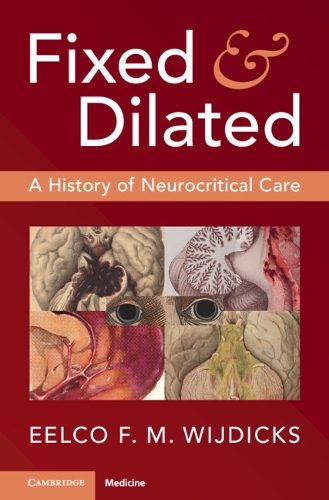 Fixed and Dilated: A History of Neurocritical Care.