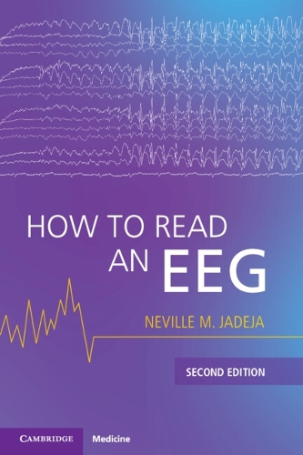 How to Read an EEG. 2nd Revised edition