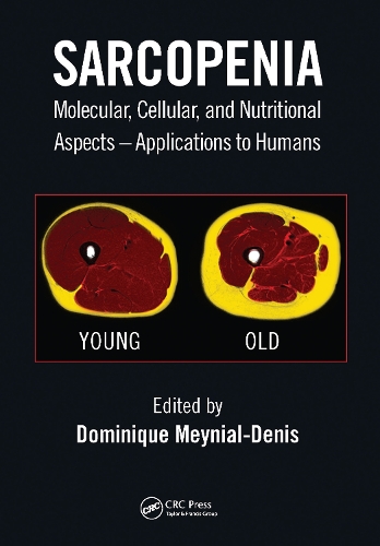 Sarcopenia: Molecular, Cellular, and Nutritional Aspects - Applications to Humans.