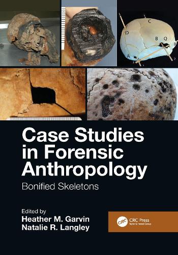 Case Studies in Forensic Anthropology: Bonified Skeletons.