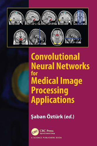 Convolutional Neural Networks for Medical Image Processing Applications.