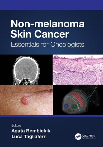 Non-melanoma Skin Cancer: Essentials for Oncologists.