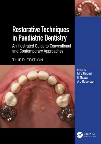 Restorative Techniques in Paediatric Dentistry: An Illustrated Guide to Conventional and Contemporary Approaches. 3rd edition