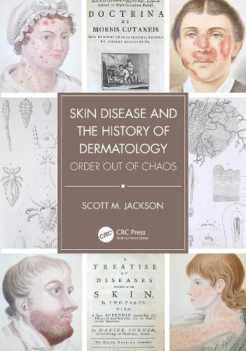 Skin Disease and the History of Dermatology: Order out of Chaos.