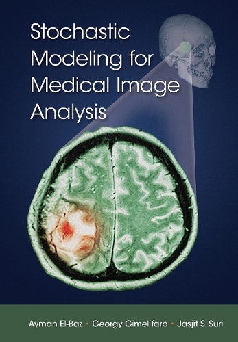 Stochastic Modeling for Medical Image Analysis.