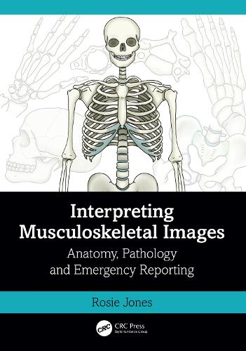 Interpreting Musculoskeletal Images: Anatomy, Pathology and Emergency Reporting.