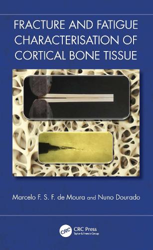 Fracture and Fatigue Characterisation of Cortical Bone Tissue.
