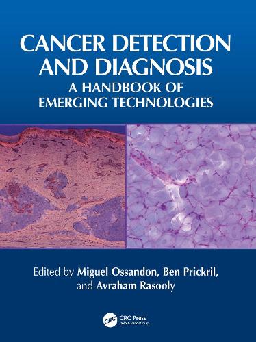 Cancer Detection and Diagnosis: A Handbook of Emerging Technologies.
