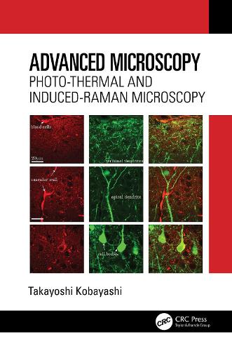 Advanced Microscopy: Photo-Thermal and Induced-Raman Microscopy.
