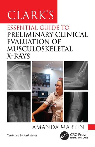 Clark's Essential Guide to Preliminary Clinical Evaluation of Musculoskeletal X-rays.