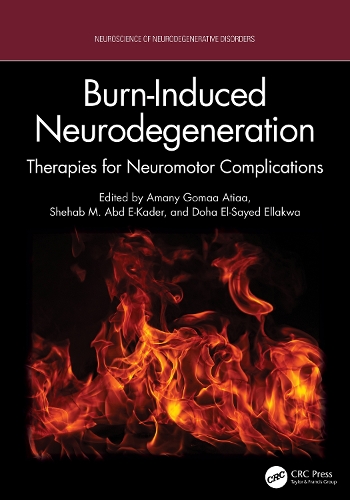 Burn-Induced Neurodegeneration: Therapies for Neuromotor Complications.