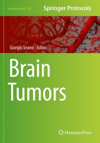 Brain Tumors. 2021 ed.