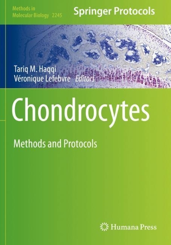Chondrocytes: Methods and Protocols. 2021 ed.