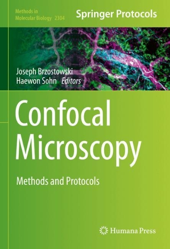 Confocal Microscopy: Methods and Protocols. 2021 ed.