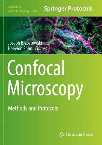 Confocal Microscopy: Methods and Protocols. 2021 ed.