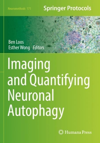 Imaging and Quantifying Neuronal Autophagy. 2022 ed.