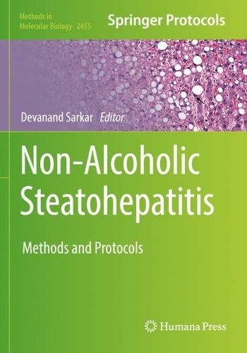 Non-Alcoholic Steatohepatitis: Methods and Protocols. 2022 ed.