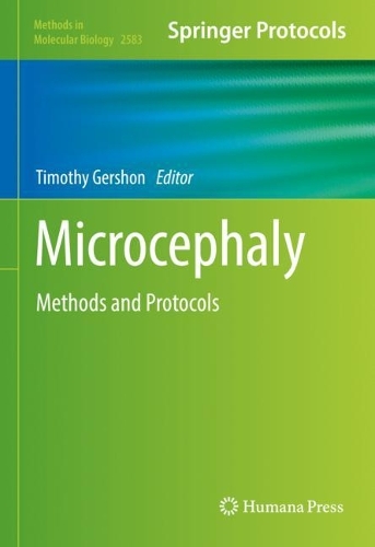 Microcephaly: Methods and Protocols. 2023 ed.