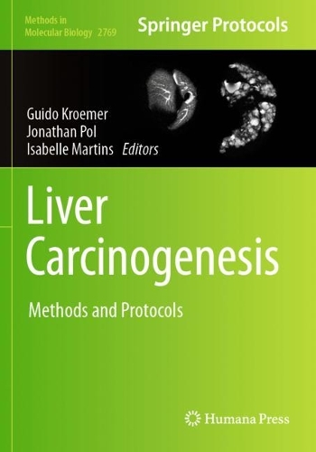Liver Carcinogenesis: Methods and Protocols.