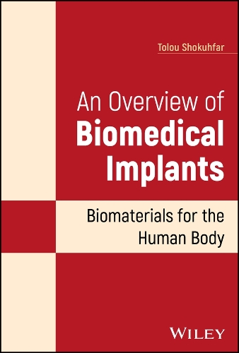 An Overview of Biomedical Implants: Biomaterials for the Human Body.